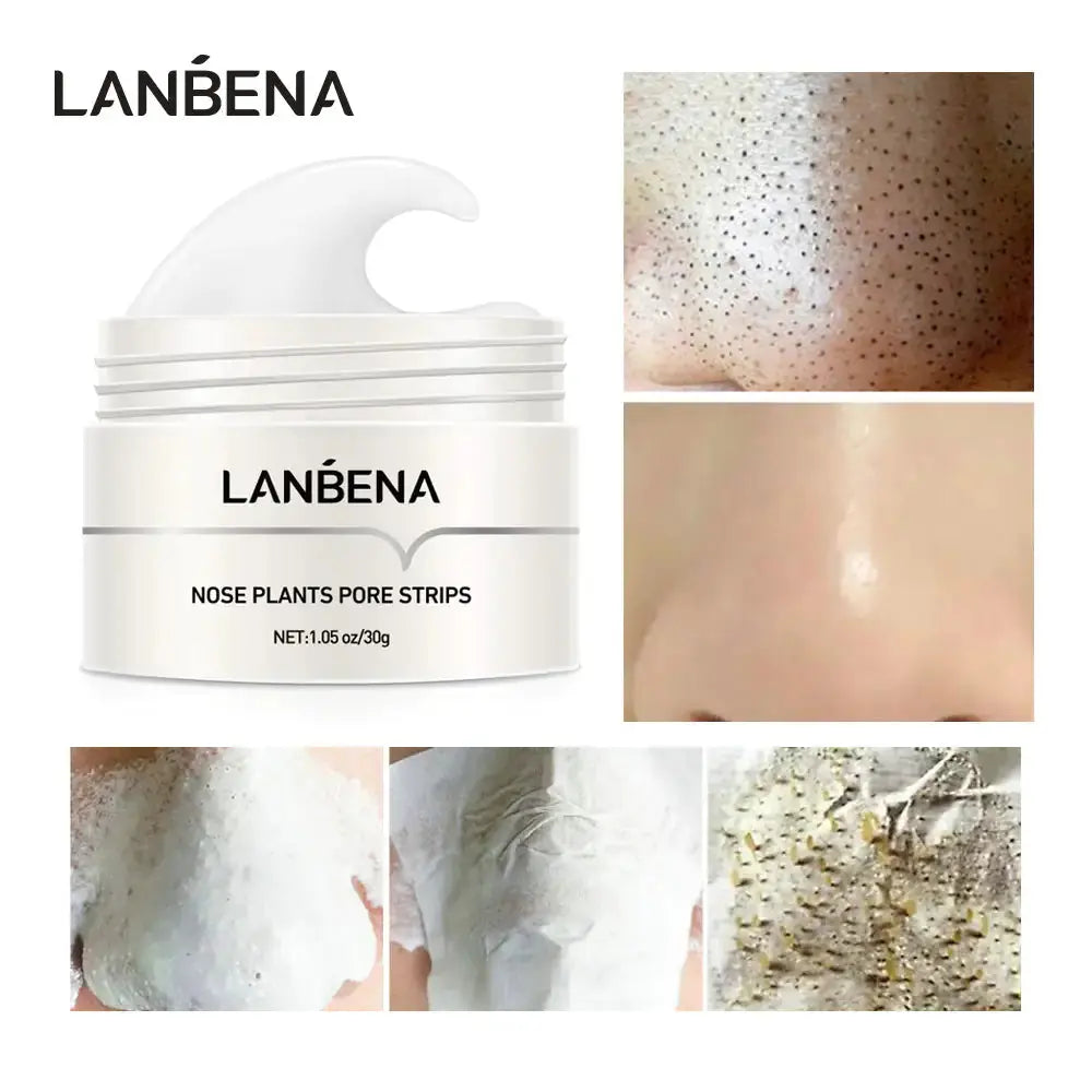 Blackhead Remover Mask - KIMDRE
