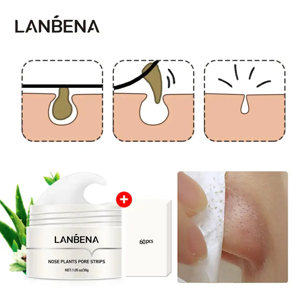 Blackhead Remover Mask - KIMDRE